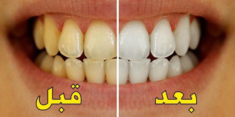 طرق منزلية لتبييض الأسنان - الخليج برس