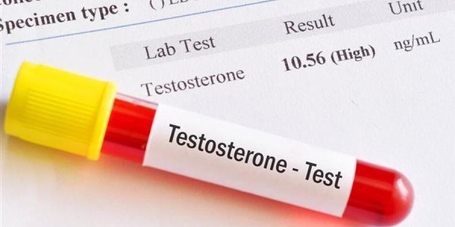 المستوى الطبيعي "لهرمون الذكورة" لدى الرجال في سن الـ50